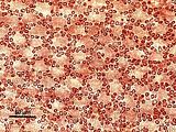 3 - Cellule corticali in visione superficiale
